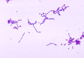 Image result for Group D Streptococcus