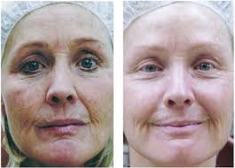 Professional Skincare