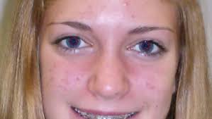 Prep roundup — Zeeland West runner Rachele Schulist takes 3rd at Portage  invite