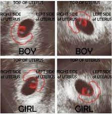 32 Old Wives Tales For Baby Gender Prediction Baby Gender Prediction Baby Gender Baby Center