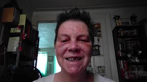 Fireworks Safety and Legality in Cherry Valley Area