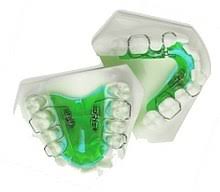 Ceramic braces are more expensive. Dental Braces Wikipedia