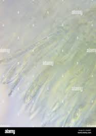 Image result for Chlorosplenium chlora