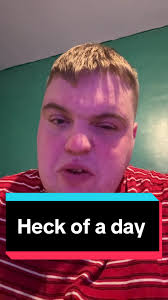 Understanding Bells Palsy and Its Challenges