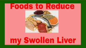 foods to reduce my swollen liver enlarged liver enlarged