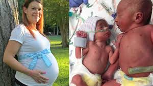 Maybe you would like to learn more about one of these? Ten Weeks That S When I Found Out I Was Having Twins 11 Weeks When I Was Guaranteed I Wouldn T Be Having Twins Baby B Is Not Going To Make It You Re Putting