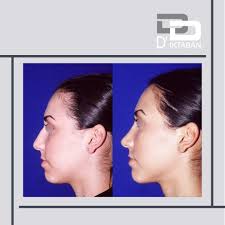 Dr. Diktaban(@drdiktaban) • Instagram 사진 및 동영상