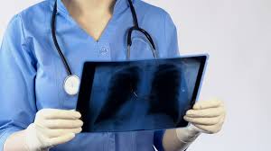 Chronische bronchitis (copd) ist eine schwerwiegende lungenkrankheit, die zwei hauptkrankheiten miteinschließt. Copd Therapieren So Kann Lungentraining Helfen Ndr De Ratgeber Gesundheit