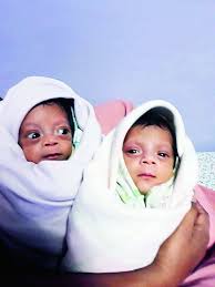 newborn baby twins in hospital