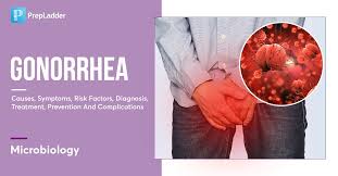 Image result for gonorrhea symptoms