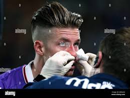 Bolton Wanderers' Reece Burke with nose bleed Stock Photo