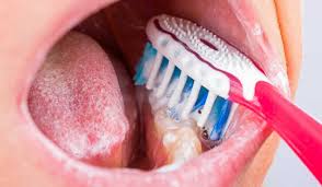 Wisdom teeth removal is surgery to extract wisdom teeth. Recovering From A Wisdom Tooth Extraction The Edge Dental