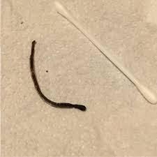 Thin Black Parasite Worm Toxoplasmosis