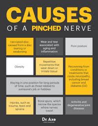 Pin On Pinched Nerve In Neckl