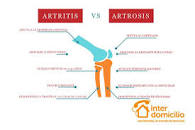 Resultado de imagen para diferencia entre artritis y artrosis