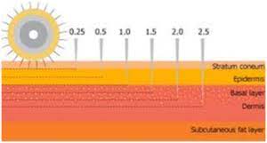 An in vitro study published in the european journal of pharmaceutical sciences looked at the effects of a microneedle device (dermaroller®) with various needle lengths including 150, 500 and 1500 micrometers. Effectiveness Of Dermarollers Depend On Needle Size And Serum Formulation Derma Roller Shop