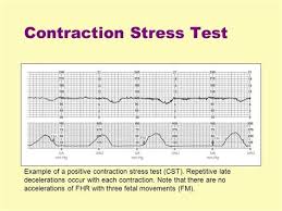 Image result for Contraction Stress Test