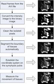 Flow Chart Of Ultrasound Image Analysis Download