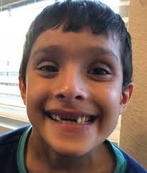 As adults, the tooth fairy is a distant memory. Loose Baby Teeth To Pull Or Not To Pull Bliss Dental
