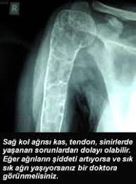 kadinlarda sag kol agrisi nedenleri onikibilgi com
