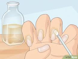 Amazon.com has been visited by 1m+ users in the past month How To Stop Your Cuticle Skin From Peeling With Pictures