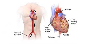 There are a lot of people who know and understand how important the heart is. Medical Surgery Test For Cardiac Disorders Trivia Quiz Proprofs Quiz