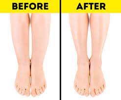 Apr 29, 2011 · while it can't change the bone structure, the soleus does run right down to the ankle bone and you can increase its size with the right training. Why You Have Cankles And 7 Tips To Help You Deal Fix Them