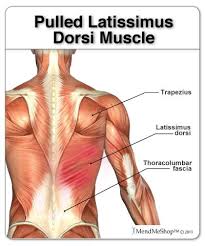 Pin On Back Pain Chiropractic Sciatica