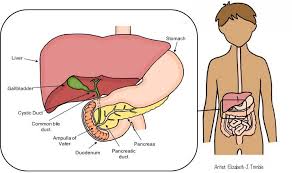 How do you treat gallstones? Gallbladder Disease In Children Healthychildren Org