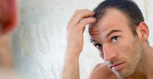 Maybe you would like to learn more about one of these? Bedanya Rambut Rontok Dengan Penipisan Rambut Bisa Disebabkan Oleh Penyakit