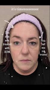 XERA Skincare Launch