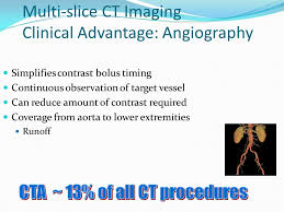 Multislice Ct Scan Ppt Ct Scan Machine
