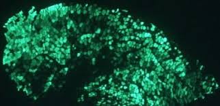 Feeling nervous before a fight or commentating is something normal for julianna peña. Atrophy Can Be Combated By Boosting Expression Of An Enzyme Produced In Muscles Eurekalert Science News