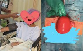Kemudiaan saya jumpa doktor di hospital besar selama 6 bulan. Akibat Terlalu Obses Jamu Dan Kolagen Gadis Jalani Pembedahan Buang Fibroid Free Malaysia Today Fmt