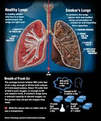 Nothing Found For Healthy Lungs Vs Smokers Lungs Healthy Lungs Smokers Lungs Lunges