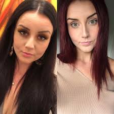 Is there a difference in your face since losing weight?