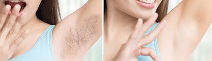 We are proud to be your preferred laser clinic for hair removal and medical spa for advanced aesthetics, injectables, and skincare. Laser Hair Removal Packages Here In London