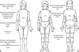 A thick, coagulated crust, slough which develops following a burn injury or chemical or physical cauterization of skin.• in full thickness circumferential burns, coagulated collagen acts as a tourniquet in leading to vascular compromise of the affected body parts.• Escharotomy And Burn Care Anesthesia Key