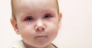 Tips Mengatasi Sakit Mata Pada Bayi Popmama Com
