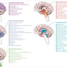 An incurable childhood brain tumor. Cns Tumour Presentation Symptom Or Sign Caused By Raised Intracranial Download Scientific Diagram