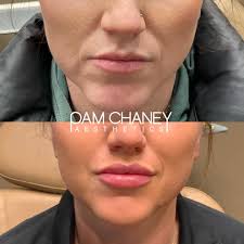 Going to a home party & want to check to see if your injector is licensed?  Check out in.gov and search the name of your injector. In todays world,  there are many