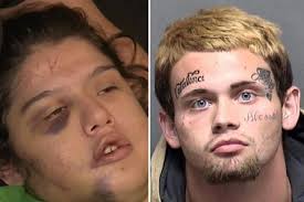 Texas teen allegedly carved his name into girlfriend's face