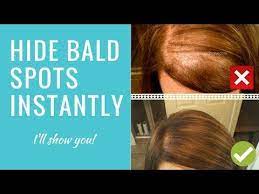 Maybe you would like to learn more about one of these? Bumble And Bumble Hair Powder For Bald Spots Thin Hair Hair Color Spray Thin Hair Styles For Women Bald Spot