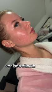 Stella Detaellenaere