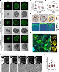 For if jason dyke is right, his idea will soon change the world and shift the delicate balance of power from one nation to another.jason's idea is simple: Nanoscale Dynamism Of Actin Enables Secretory Function In Cytolytic Cells Current Biology