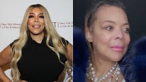 8 Celebrities Who Took Off Their Wigs And Showed Their Real Hair