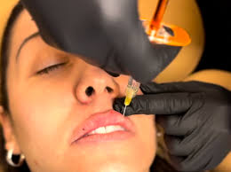 Injectables: Tox & Fillers