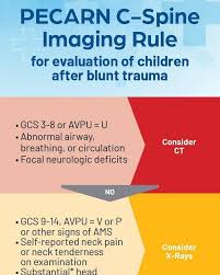 Image result for PECARN Pediatric Intra-Abdominal Injury Algorithm