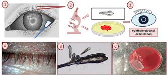 Image result for Demodex brevis
