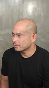 MANScalp Philippines scalp micropigmentation review and experience